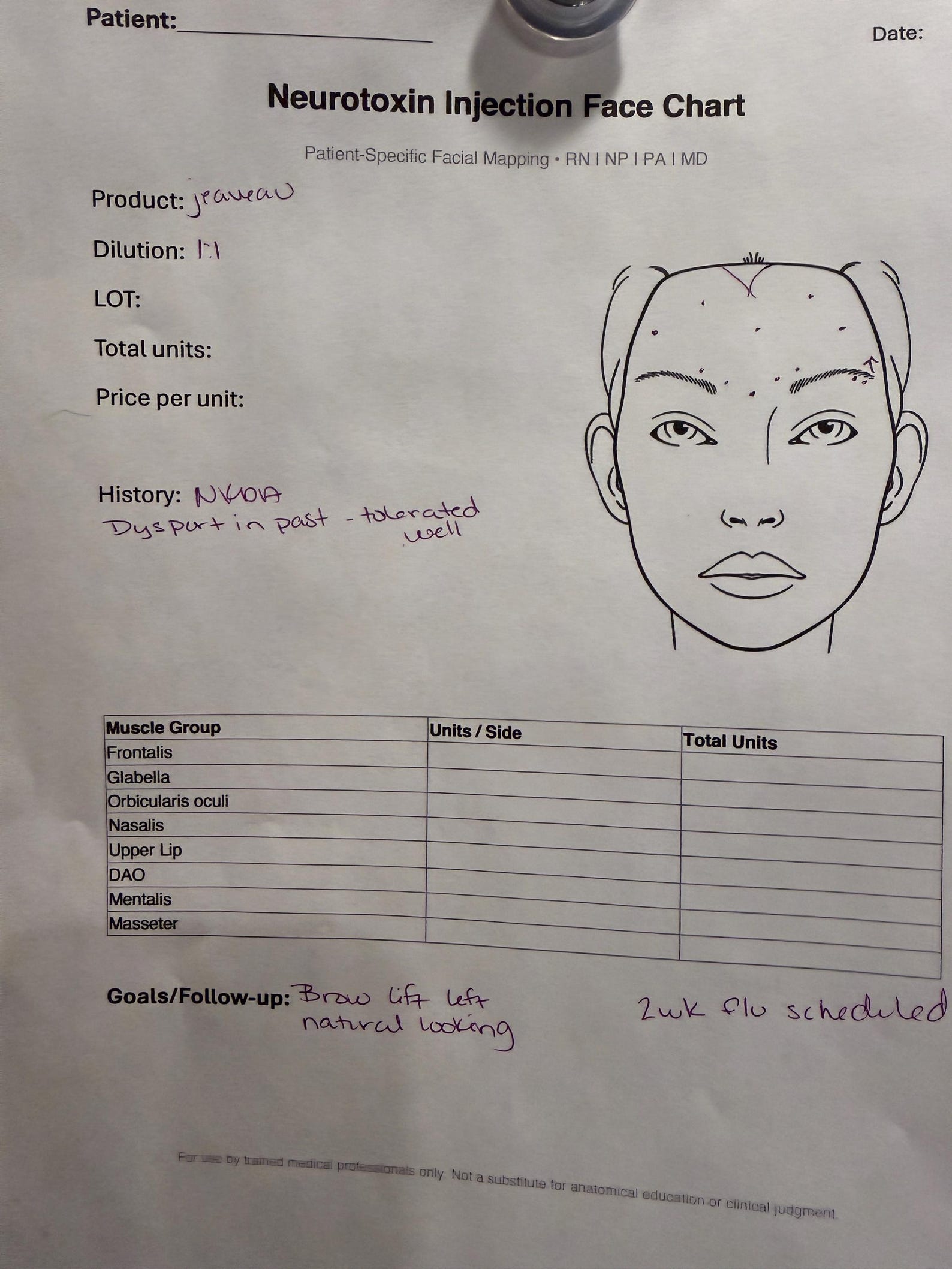 Cadi Injection Chart Neurotoxin Injection Face Chart | Patient Facial Mapping PDF | Botox ...