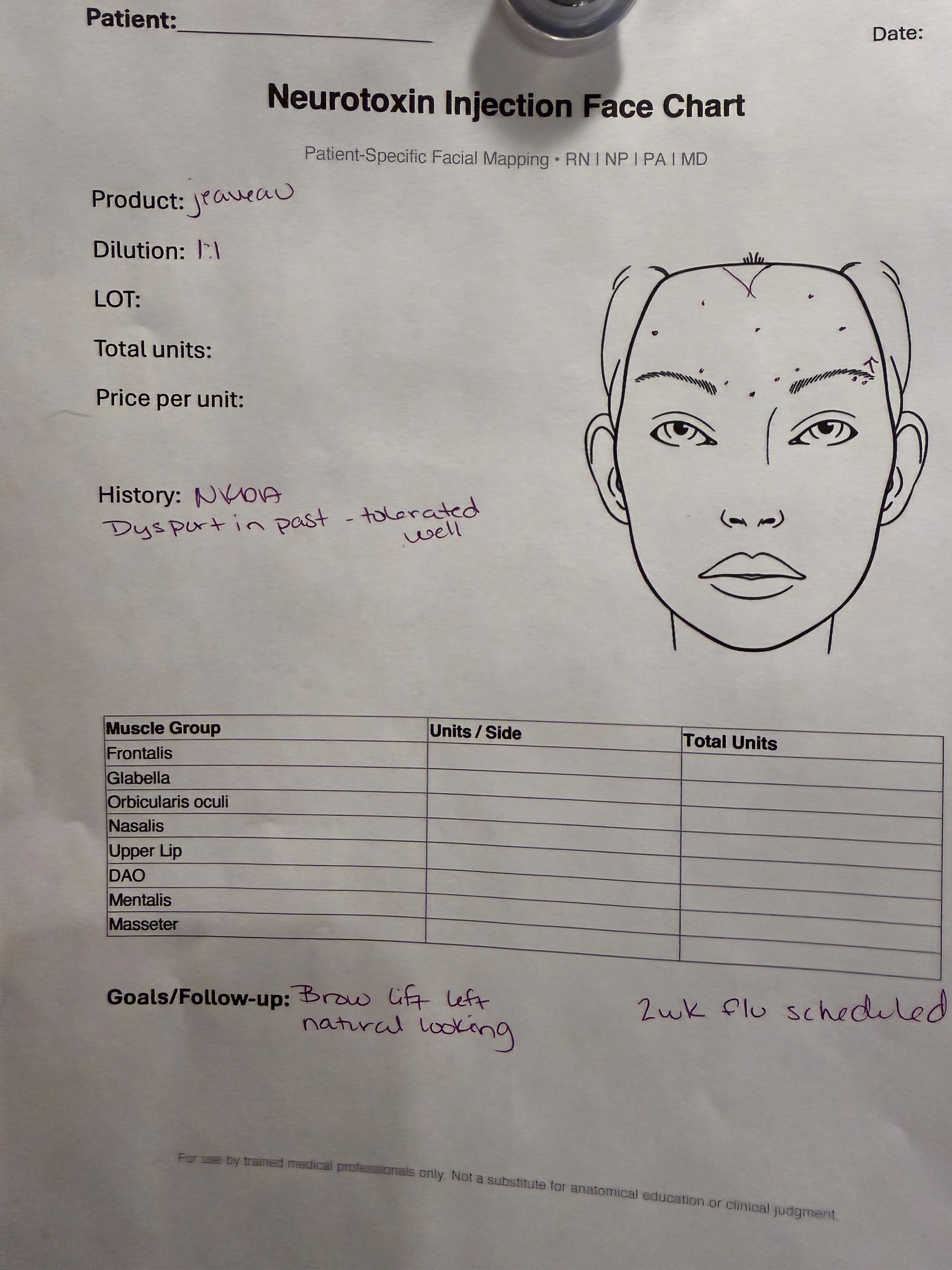 Printable Injection Pictures Neurotoxin Injection Face Chart | Patient Facial Mapping PDF | Botox ...