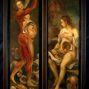 Decoración gótica del hogar / Curiosidades y rarezas Láminas de arte de pared extrañas y oscuras Anatomía médica / Figura disecada de una mujer embarazada vista lateral