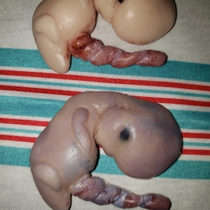 Puede incluir: Dos modelos fetales, uno con un ojo negro, se muestran sobre un fondo a rayas. Los modelos son de color rosa pálido con un cordón umbilical retorcido. Los modelos están en posición fetal.