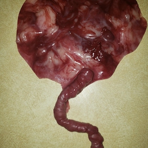 Aviso: Imagem ilustrativa** Placenta e cordão umbilical de silicone para bebê de silicone