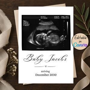 Puede incluir: Una tarjeta de anuncio blanca con una imagen de ecografía en blanco y negro en la parte superior. Debajo de la imagen, el texto dice Baby Jacobs, un pequeño icono de corazón y el texto arriving December 2030. Una insignia circular dice Editable in Canva.