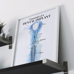 Puede incluir: Una lámina enmarcada titulada Components of a DENTAL IMPLANT, con una ilustración en acuarela de un implante dental. El diagrama etiqueta los componentes crown, screw, abutment y fixture en texto negro sobre un fondo de acuarela azul.