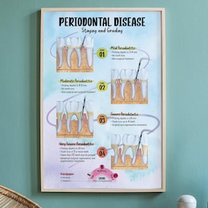 May include: A framed poster illustrating the stages of periodontal disease, with diagrams of teeth and gums. The text "PERIODONTAL DISEASE Staging and Grading" is at the top. The poster shows stages 1-4, with probing depths and tooth loss details.