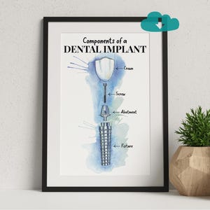 May include: A framed educational print titled Components of a DENTAL IMPLANT, featuring a watercolor illustration of a dental implant assembly. The diagram labels the crown, screw, abutment, and fixture against a blue watercolor background.