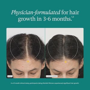 May include: Image showing two side-by-side photos of a person's scalp, labeled "BEFORE" and "6 MONTHS GROWING." The text at the top reads "Physician-formulated for hair growth in 3-6 months." The bottom text states the study results.