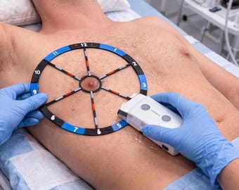 Breast Ultrasound Localisation Tool | Radial Clock-Face Ruler (Nipple-Centred Grid)