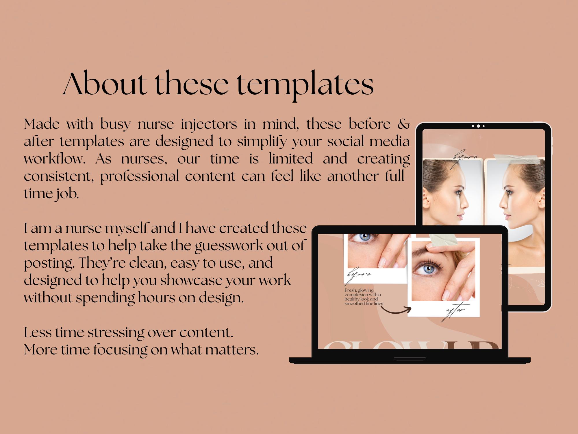 Nurse Injector Before & After Instagram Templates | Botox and Filler ...