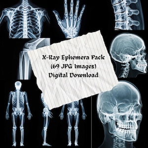 May include: A collage of X-ray images of human anatomy, including a hand, skull, spine, and full skeletal figures. A paper overlay reads "X-Ray Ephemera Pack (69 JPG Images) Digital Download."