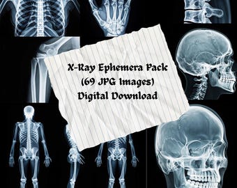 X-Ray Ephemera Pack (69 Images) – Vintage Medical Xray Printable, Anatomy Bones, Dark Academia Junk Journal, Gothic Collage Digital Download