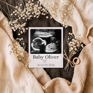 Könnte beinhalten: Ein Schwarz-Weiß-Ultraschallbild eines Babys, präsentiert auf einer weißen Karte mit dem Text "Baby Oliver", einem Herzsymbol und "AUGUST 2026". Die Karte ist von beigem Stoff, Trockenblumen und einem Holzring umgeben.