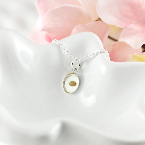 Vangelo Secondo Matteo 17:20 (NR94) - Gesú Rispose Loro: «A Causa - Foto 6