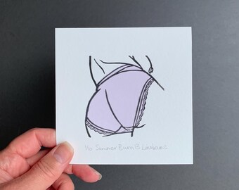 Linocut Print | Summer Bum 13