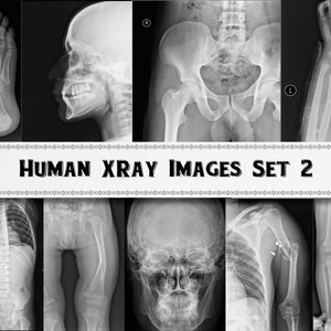 X-Ray Images Set 2 / Medical Graphics / Digital Download / Commercial Use / Bones Clipart
