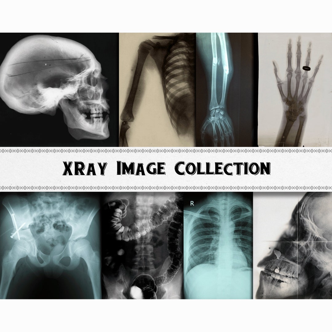 Rayペ-ジ il_1080xN.5664903965_ovy7.jpg