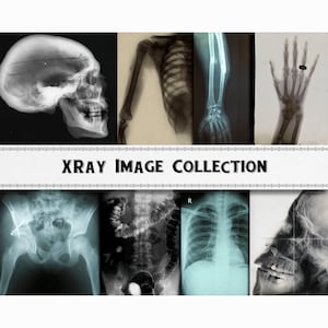X-Ray Images / Medical Graphics / Digital Download / Commercial Use / Bones Clipart