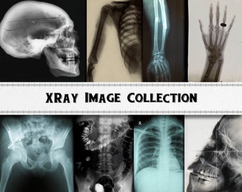 May include: A collection of black and white x-ray images showing different parts of the human body, including a skull, hand, arm, chest, spine, and pelvis. The images are arranged in a grid pattern and have a vintage feel.