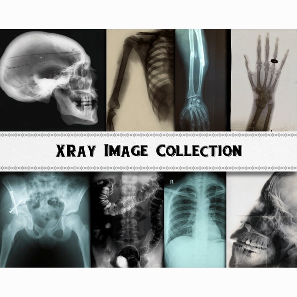 X-Ray Images / Medical Graphics / Digital Download / Commercial Use / Bones Clipart