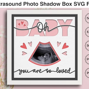 Baby Ultrasound Shadow Box File SVG per progetti Cricut, Ultrasound Display, Baby Shower Decor Gift per mamma, Annuncio di gravidanza, 3d SVG