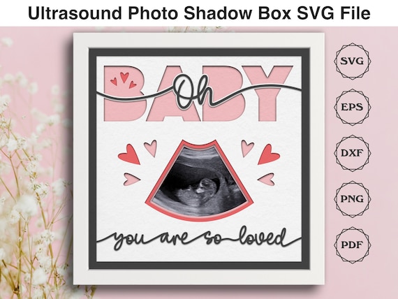 Pregnancy Shadow Box