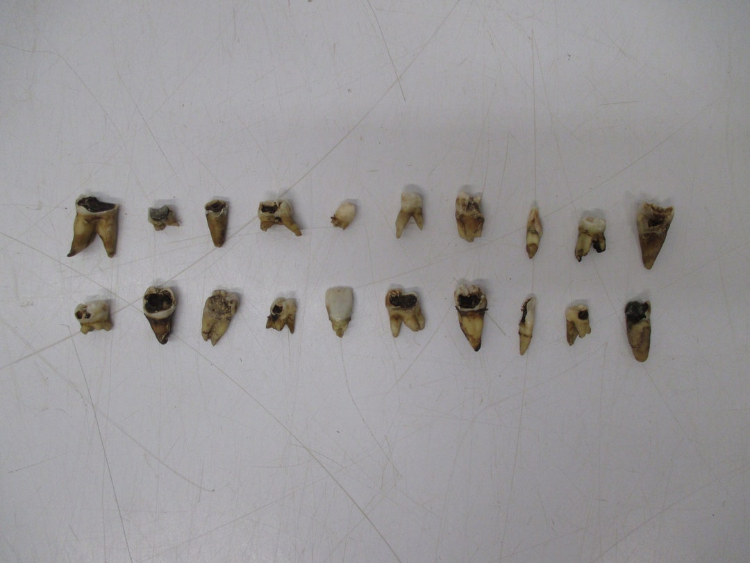 Lot 20 Assorted Human Tooth Teeth Extracted Vintage Dental Research ...
