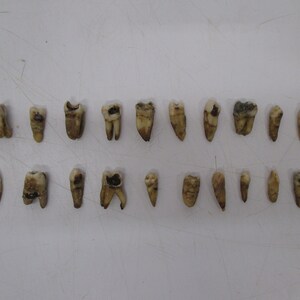 Lot 20 Assorted Human Tooth Teeth Extracted Vintage Dental Research Oddity Dentist #J13