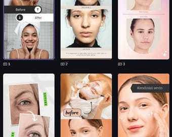 Beauty Before & After Canva Instagram Story Templates