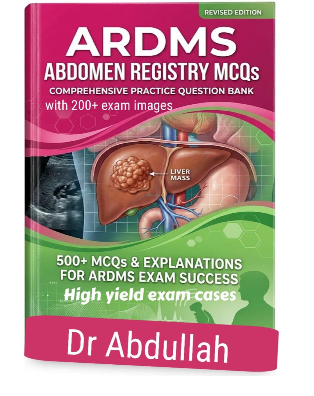 ARDMS Abdomen Mcqs Book - Etsy