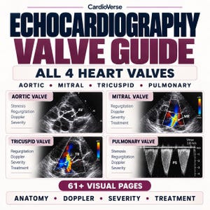 Puede incluir: Una guía educativa titulada CardioVerse Echocardiography Valve Guide All 4 Heart Valves. Incluye imágenes médicas de ultrasonido de las válvulas aórtica, mitral, tricúspide y pulmonar con etiquetas de texto para estenosis, regurgitación y Doppler.