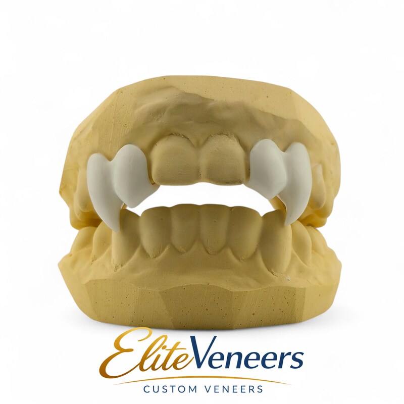 Custom Vampire Fangs Veneers - Etsy