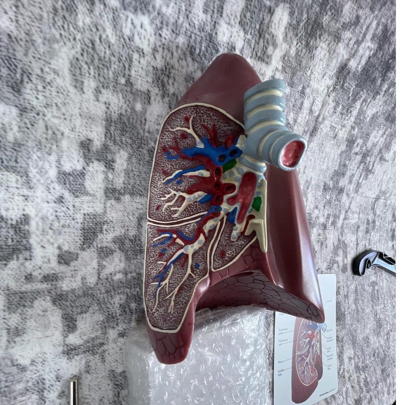 Vtg GPI Anatomical Lung Model – 3D Cross-section Teaching Model W ...