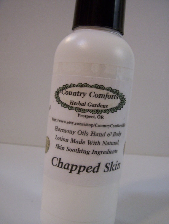 Items similar to Chapped Skin Hand & Body Lotion Chapped, cracked skin lotion, dry skin