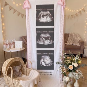 Pode incluir: Um estandarte vertical de tecido branco com três imagens de ultrassom em preto e branco, laços cor-de-rosa no topo e acabamento em renda. O texto na parte inferior diz Our Little Miracle 15 OCT 2026 com um ícone de coração, estrela e pegada.