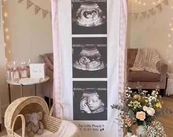Puede incluir: Un estandarte vertical de tela blanca con tres imágenes de ecografías en blanco y negro, lazos rosas en la parte superior y borde de encaje. El texto en la parte inferior dice Our Little Miracle 15 OCT 2026 con un icono de corazón, estrella y huella.