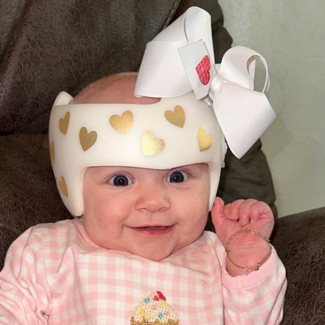 Baby Helmet Stickers, Doc Band Decals, Cranial Helmet Decals for Baby Girl Etsy