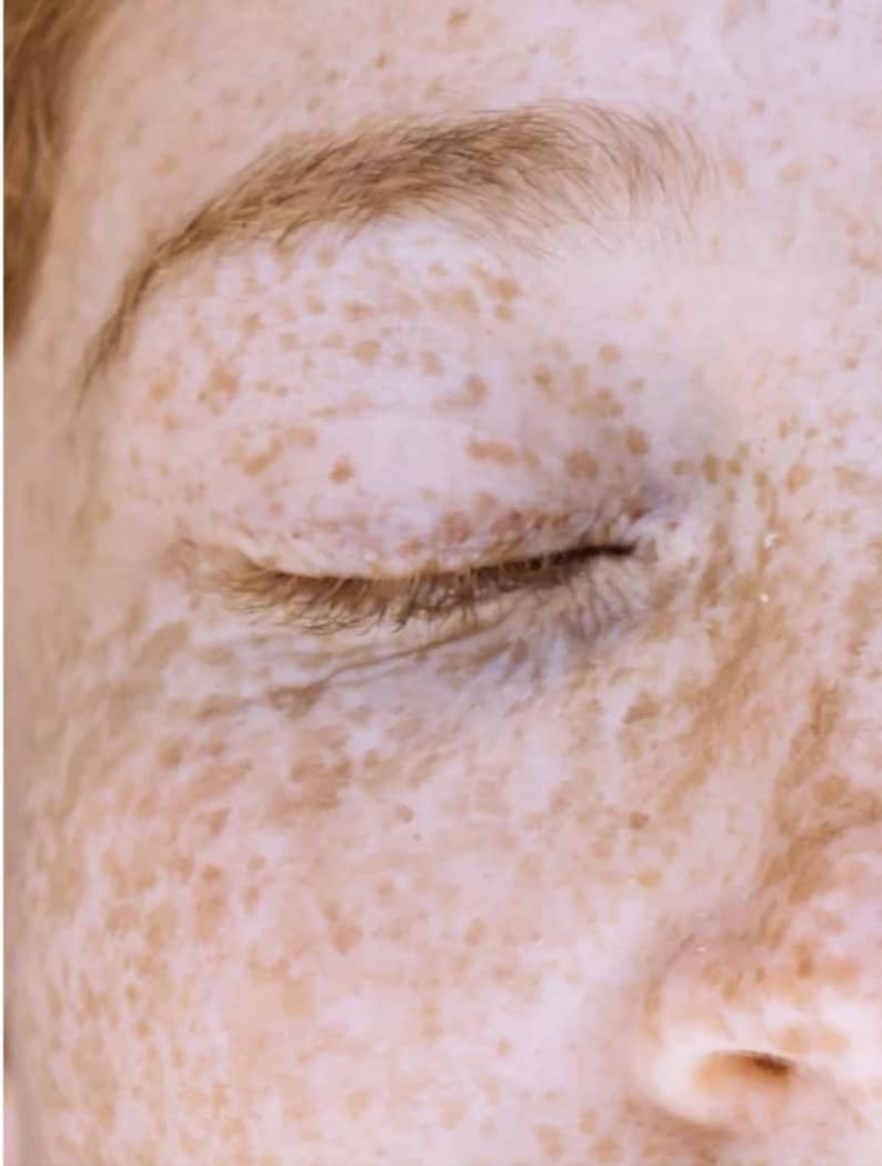 May include: Close-up of a person's closed eye and eyebrow. The skin is light-toned with numerous freckles. The eyebrow is a light brown color, and the eyelashes are visible. The overall image has a soft, natural aesthetic.