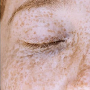 K&ouml;nnte beinhalten: Nahaufnahme eines Gesichts mit geschlossenen Augen und einer markanten Augenbraue. Die Haut ist hell mit zahlreichen Sommersprossen in verschiedenen Braunt&ouml;nen. Das Bild konzentriert sich auf das Auge und die umgebende Haut und hebt die nat&uuml;rliche Hautstruktur und Details hervor.