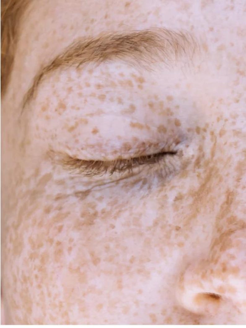 K&ouml;nnte beinhalten: Nahaufnahme eines Gesichts mit geschlossenen Augen und einer markanten Augenbraue. Die Haut ist hell mit zahlreichen Sommersprossen in verschiedenen Braunt&ouml;nen. Das Bild konzentriert sich auf das Auge und die umgebende Haut und hebt die nat&uuml;rliche Hautstruktur und Details hervor.