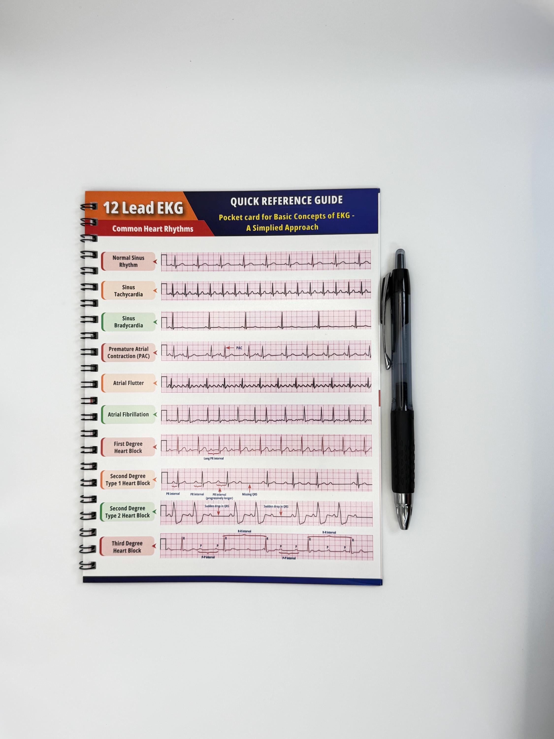 EKG Quick Reference Guide - Etsy