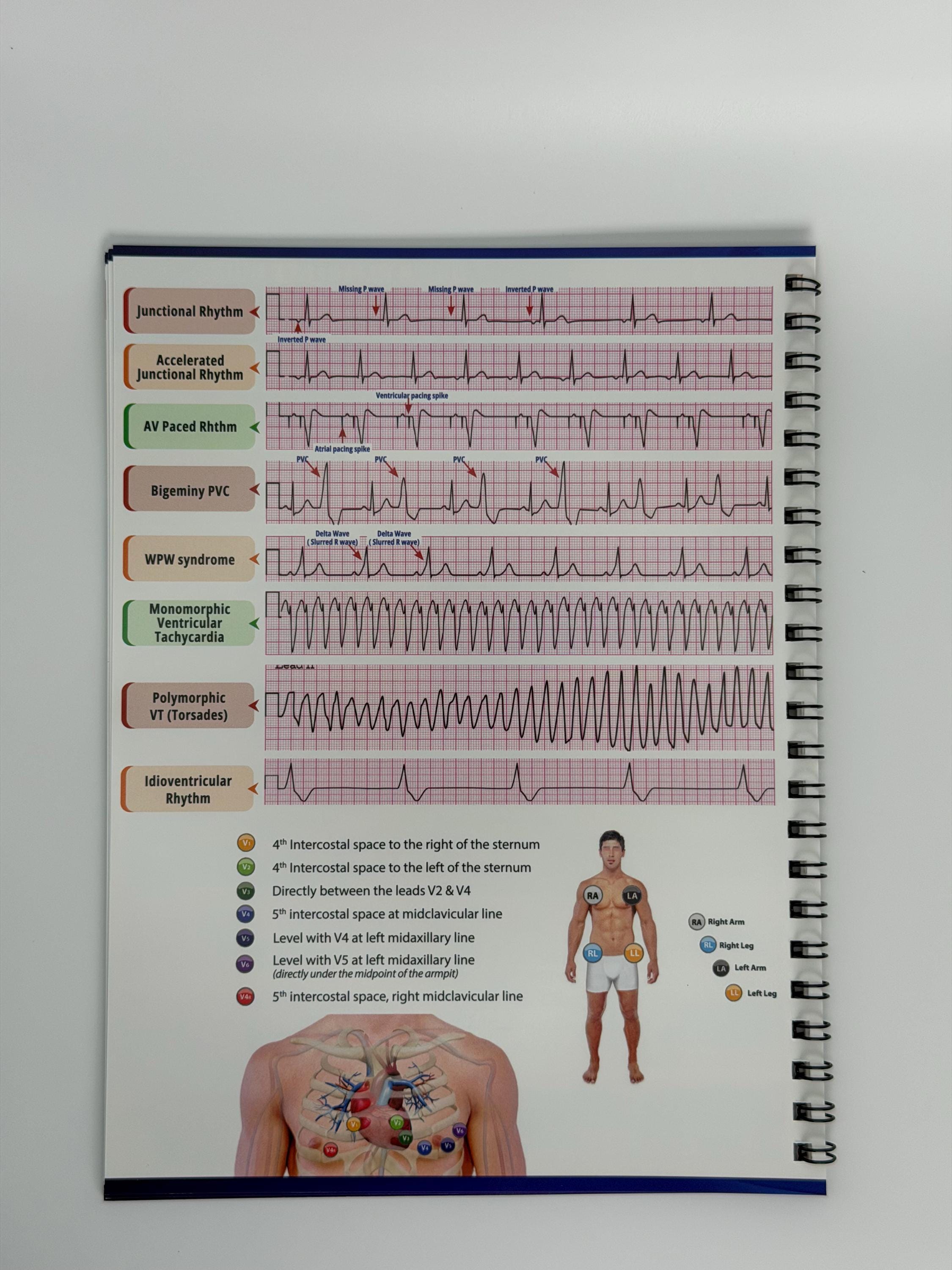 Ekg Steps Quick Guide.pdf EKG Quick Reference Guide - Etsy