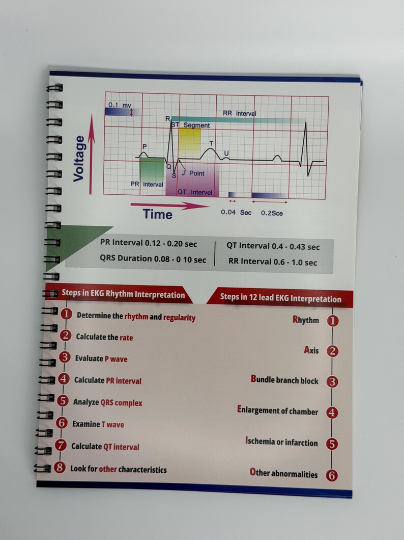 EKG Quick Reference Guide - Etsy