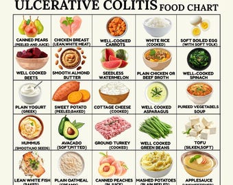 Ulcerative Colitis Food Chart Printable, UC Diet Food List, Digestive Health Meal Planner PDF, Instant Download