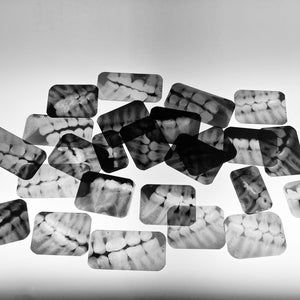 Vintage Dental Teeth X-rays for Craft Mixed Media Projects
