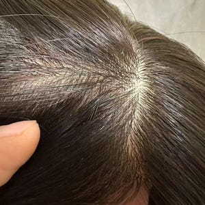 Black Silk Base Human Hair Toppers: 7x8 Virgin Remy Hair Piece Breathable Comfort Clips in for Baldness Hair Loss image 7