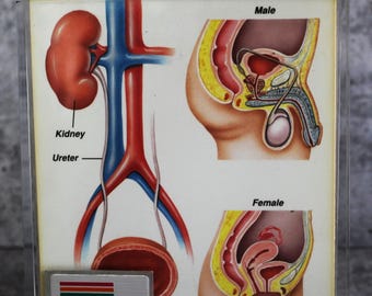 vintage Medical Cards -Display/Doctor&#39;s Office/Study - Anatomy and Ailments front and backside