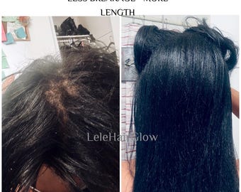Complete 4-Step Hair Growth System | Thicker, Longer Hair | Anti-Shedding, Regrowth | Natural Hair Care Bundle