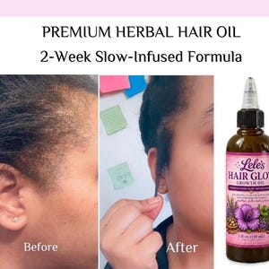 Pode incluir: Um frasco de pl&aacute;stico castanho de &oacute;leo capilar Lele's Hair Glow com uma ponta aplicadora. O r&oacute;tulo apresenta uma flor de hibisco roxa, ervas verdes e o texto Premium Herbal Hair Oil, 2-Week Slow-Infused Formula e 150 ml.