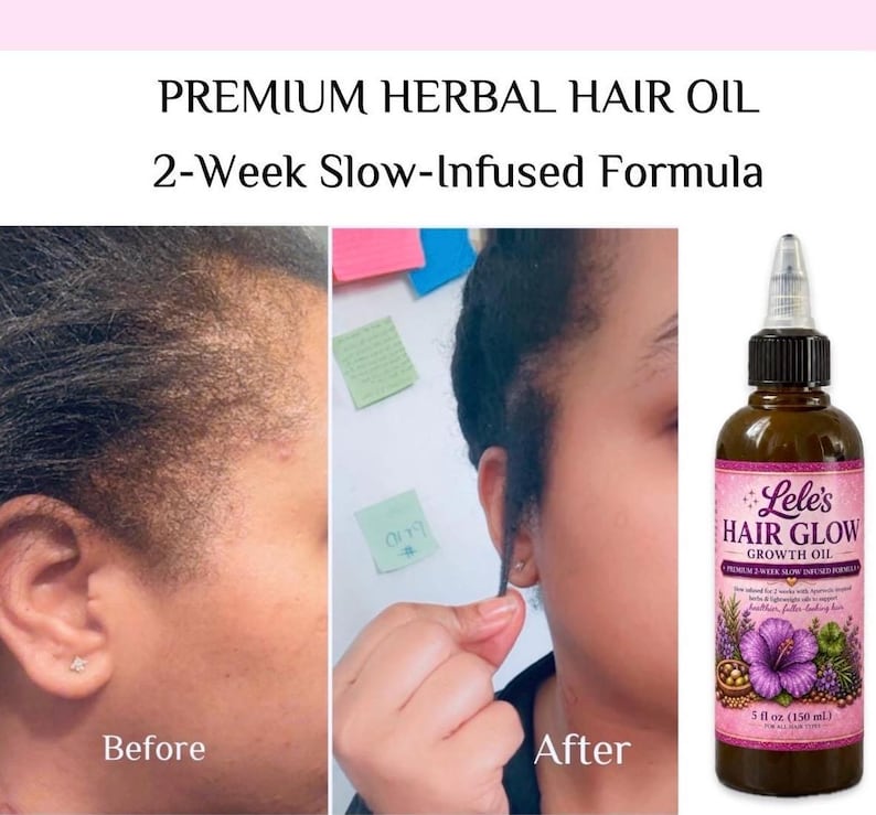 Pode incluir: Um frasco de pl&aacute;stico castanho de &oacute;leo capilar Lele's Hair Glow com uma ponta aplicadora. O r&oacute;tulo apresenta uma flor de hibisco roxa, ervas verdes e o texto Premium Herbal Hair Oil, 2-Week Slow-Infused Formula e 150 ml.