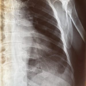 8 alte Röntgenfilme, Röntgenbilder, Medizinische Radiologie, Anatomische Tafeln, Selbstgemacht