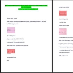 May include: Two-page document with medical information. The left page has text about normal sinus rhythm, sinus arrhythmia, and sinus bradycardia. The right page has text about sinus tachycardia and premature atrial contraction (PAC).